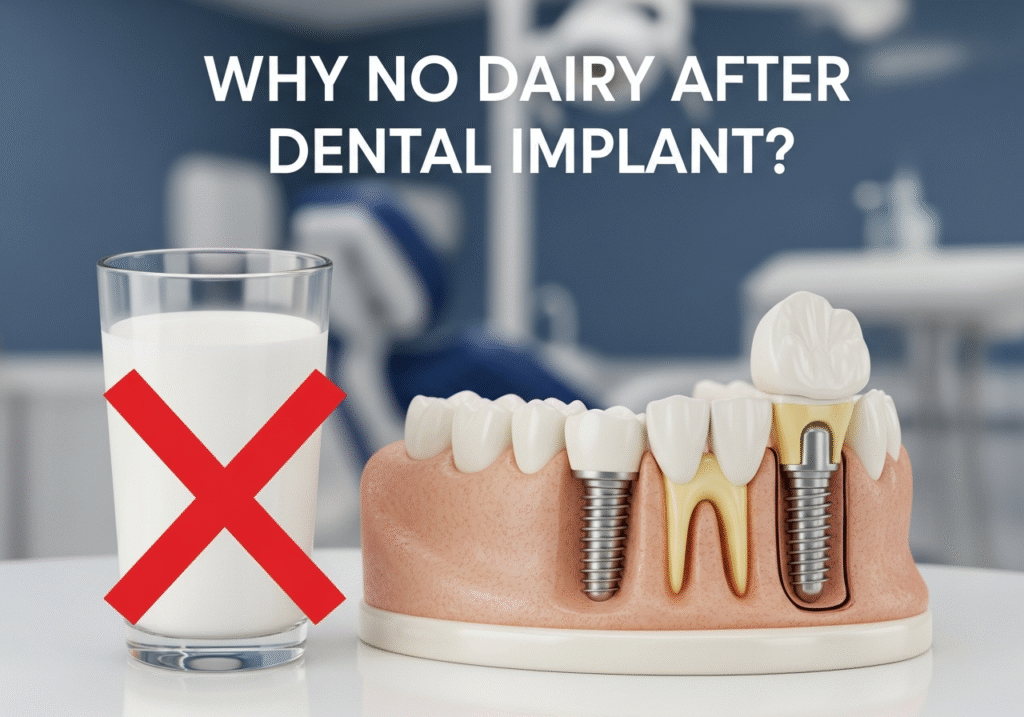Why No Dairy After Dental Implant